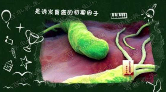 幽门螺杆菌