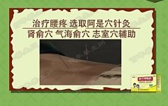 20170425饮食养生汇视频和笔记:齐小田,针灸,春笋肉丝的制作方法