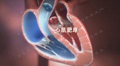 20171026养生堂视频和笔记:郑哲,窦克非,黄洁,心力衰竭,搭桥,支架