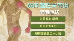 20180417医生开讲视频和笔记:冯兴华,类风湿性关节炎,忍冬藤