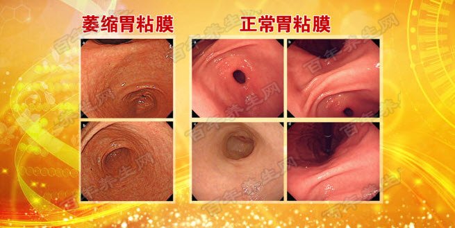 胃黏膜