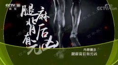 20180509健康之路视频和笔记:崔志强,腰椎间盘突出,腿麻,椎管狭窄