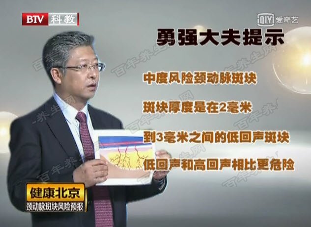 颈动脉斑块的危害