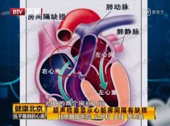 20180726健康北京视频和笔记:苏丕雄,卵圆孔,抚平脆弱的心房