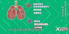 20190416X诊所视频和笔记:陈海泉,肺癌,肺小结节,微创
