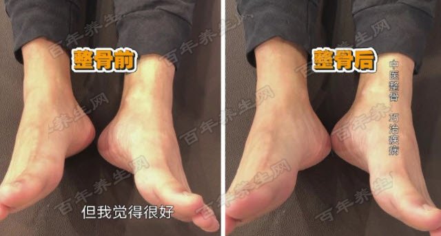 长短腿