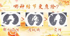 20200204养生堂视频和笔记:李泉旺,孙韬,肺结节,肺癌,软坚散结