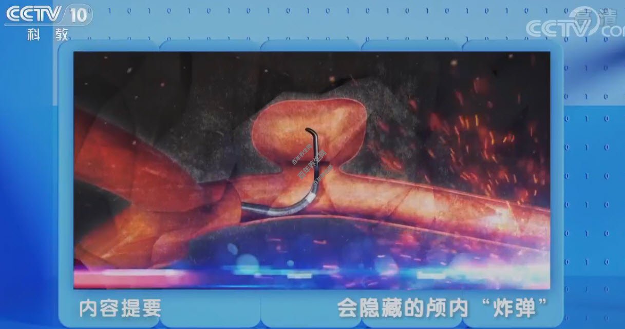 会隐藏的颅内炸弹