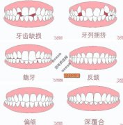 20200819X诊所视频和笔记:郭涛,牙齿不齐,糖尿病,牙齿矫正