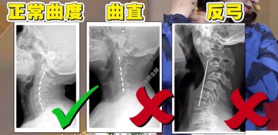 不容忽视的“颈”告
