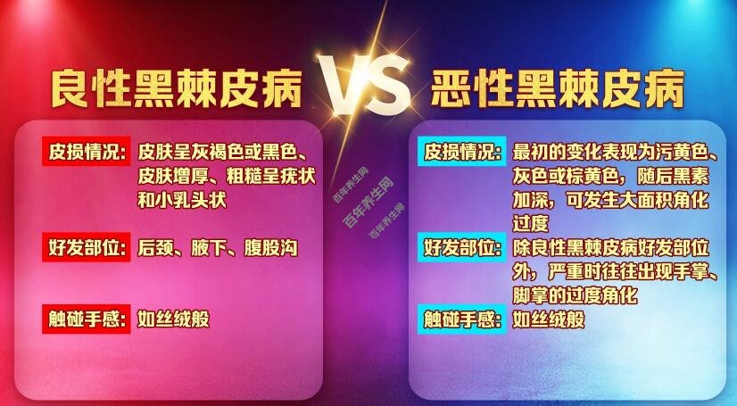 黑棘皮病的良恶性区别