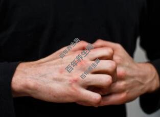 和