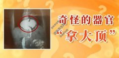 20220112养生堂视频和笔记:陈杰,杨慧琪,食道裂孔疝,B超,嗳气