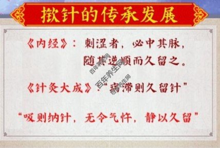 揿针的发展