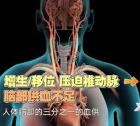 20221116X诊所视频和笔记:朱烱伟,正骨,颈椎病,头晕,腰痛