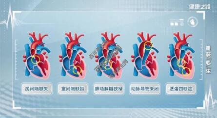 五种常见的先天性心脏病类型