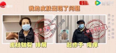 我的皮肤怎么了