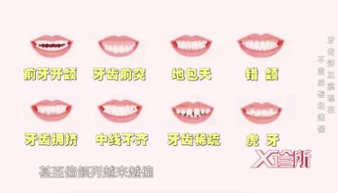 牙齿畸形