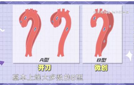 主动脉夹层的治疗