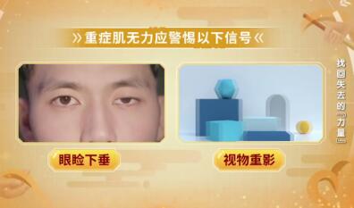 重症肌无力的信号