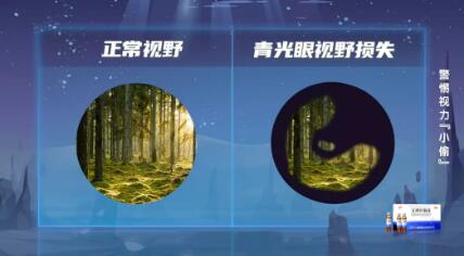 正常视野VS青光眼视野损失