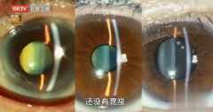 20240616Ƶͱʼ:,,Ӱ,,ư߲