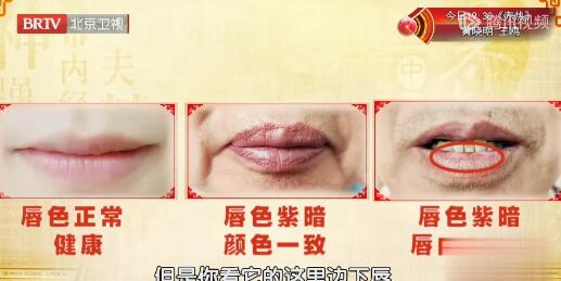 口唇的颜色