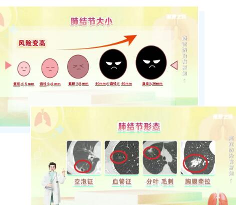 结节大小VS结节形态