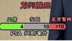 20251028健康之路视频和笔记:叶定伟,前列腺癌,前列腺特异抗原