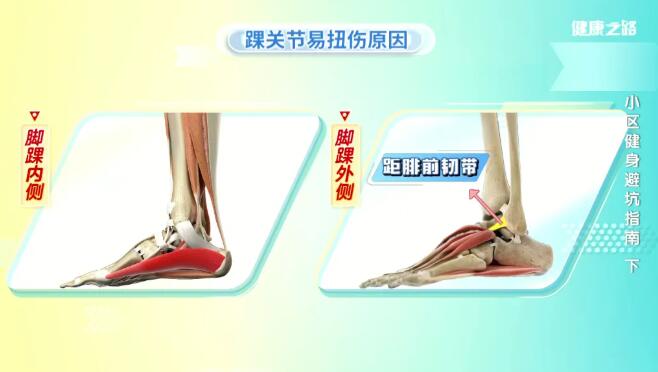 踝关节扭伤的原因