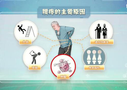 老年人腰疼的常见原因