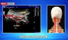 20251103Ƶͱʼ:־Զ,׾,Ѩ,Ѩ