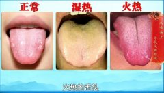 20260111��������Ƶ�ͱʼ�:������,�з�,�մ�,������,̫��Ѩ