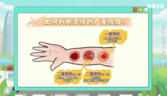 烫伤的严重程度