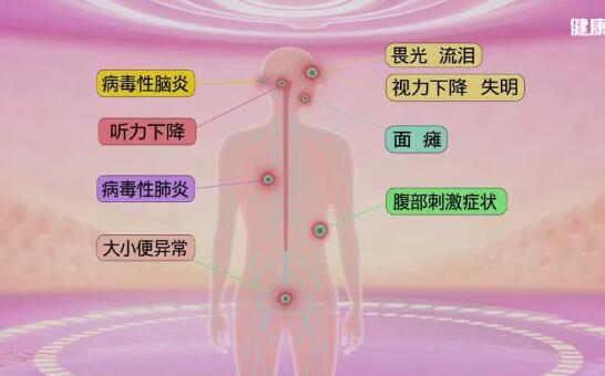 带状疱疹好发部位