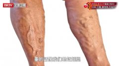 20260420��������Ƶ�ͱʼ�:��ӿȪ,�ž�,��������,ҽ�õ�����