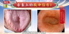 20260706��������Ƶ�ͱʼ�:��Ҫ��,��ǰ����,ή����θ��,��ҩ��